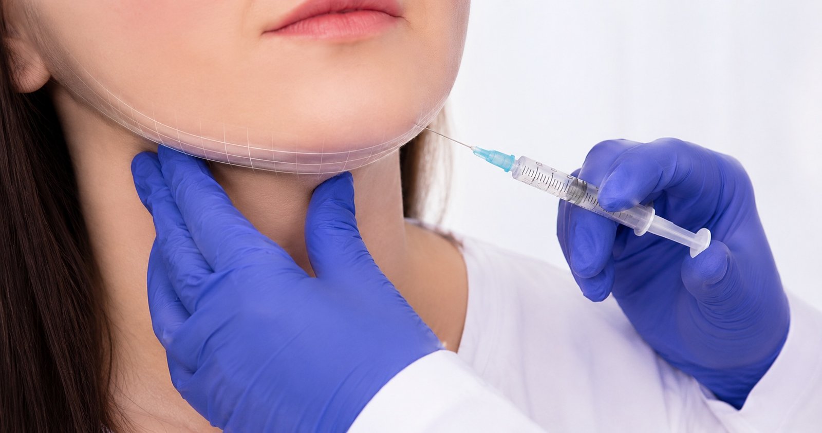 Fat-Dissolving Injections