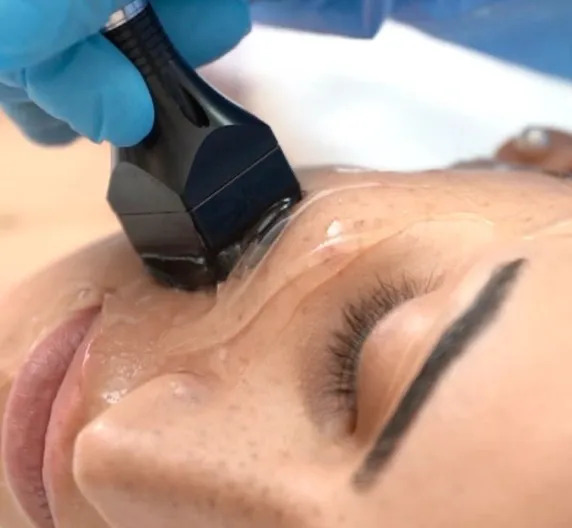 Forma treatment at Ccoco Beauty Balwyn