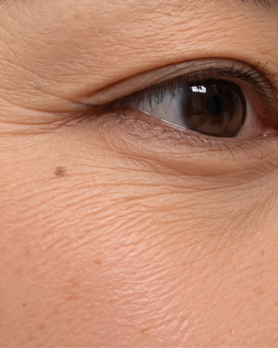 Fine Lines & Ageing illustrative skin concern