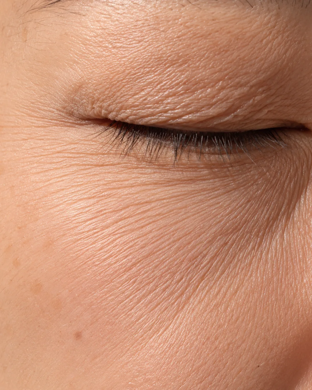 Fine Lines & Ageing