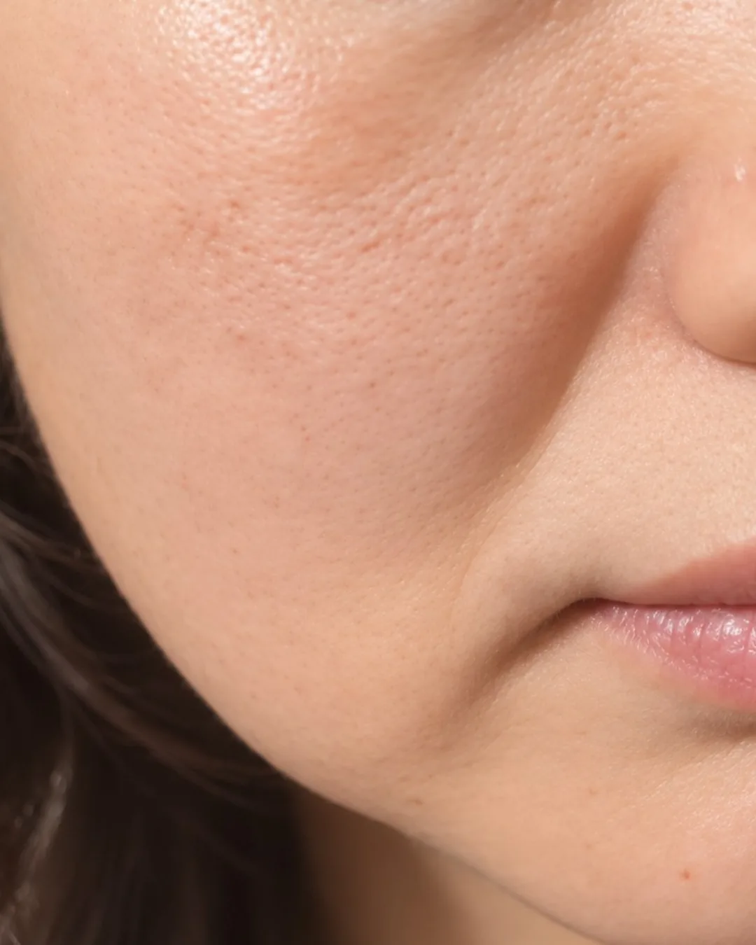 Pores & Skin Texture