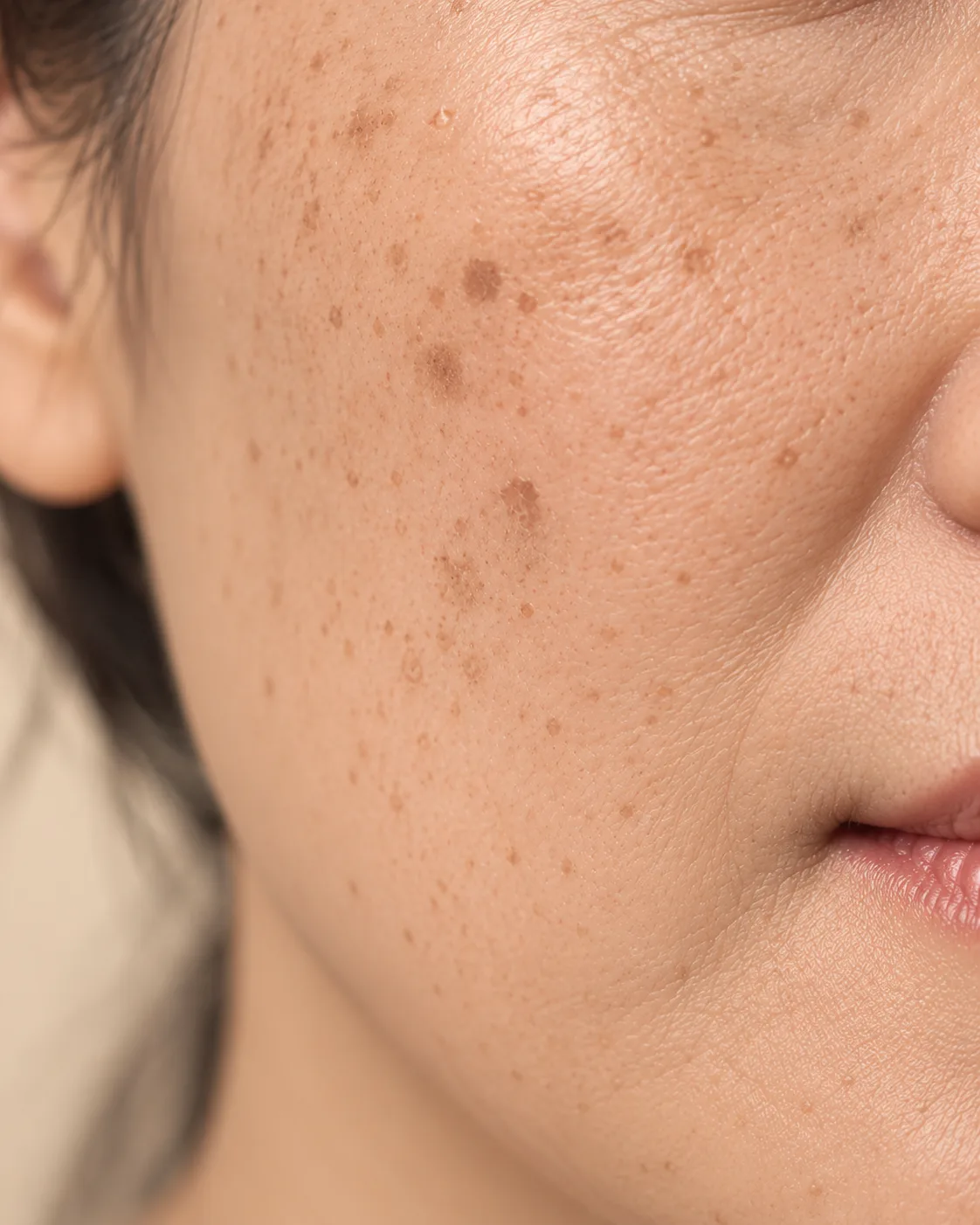 Pigmentation & Uneven Tone illustrative skin concern