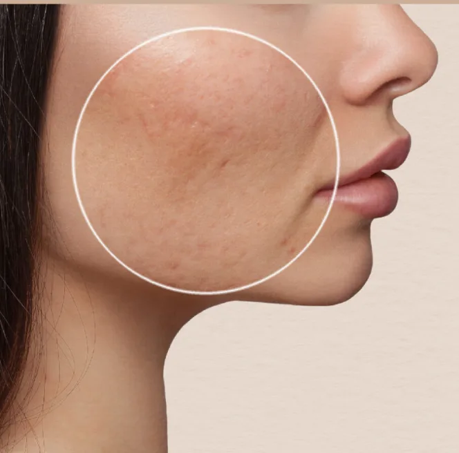 Pores & Skin Texture illustrative skin concern